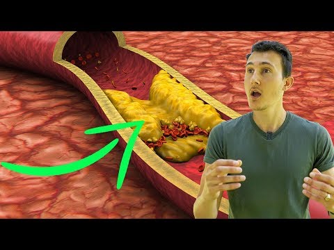 MAUVAIS CHOLESTÉROL : LA FIN DU MYTHE (il est bon pour la santé) !